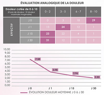 diminution douleur grossesse jupystrap